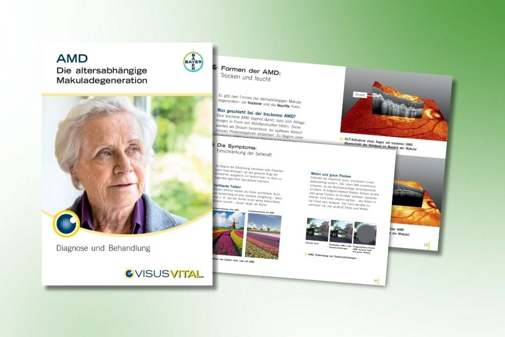 Vorschaubild VisusVital Broschüre AMD